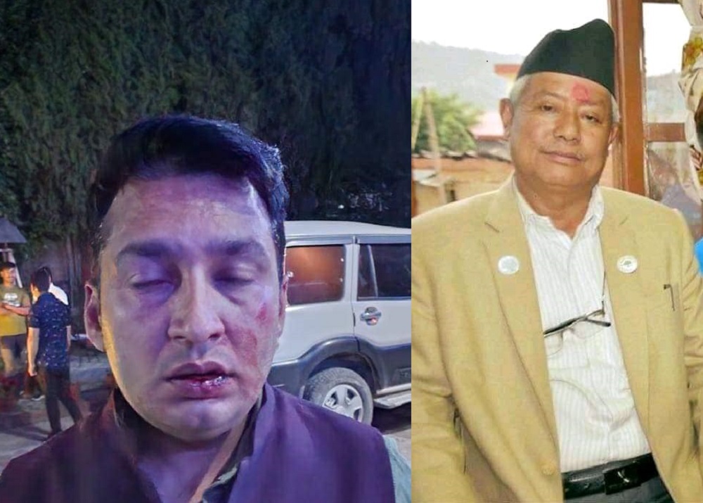 काभ्रे कांग्रेस विवाद प्रकरण: कुटपिट गर्ने मेयरका उम्मेदवार कुन्साङविरुद्ध पाण्डेले दिए उजुरी